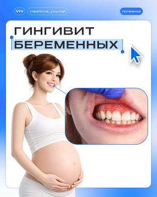 Гингивит беременных: причины и тактика лечения.